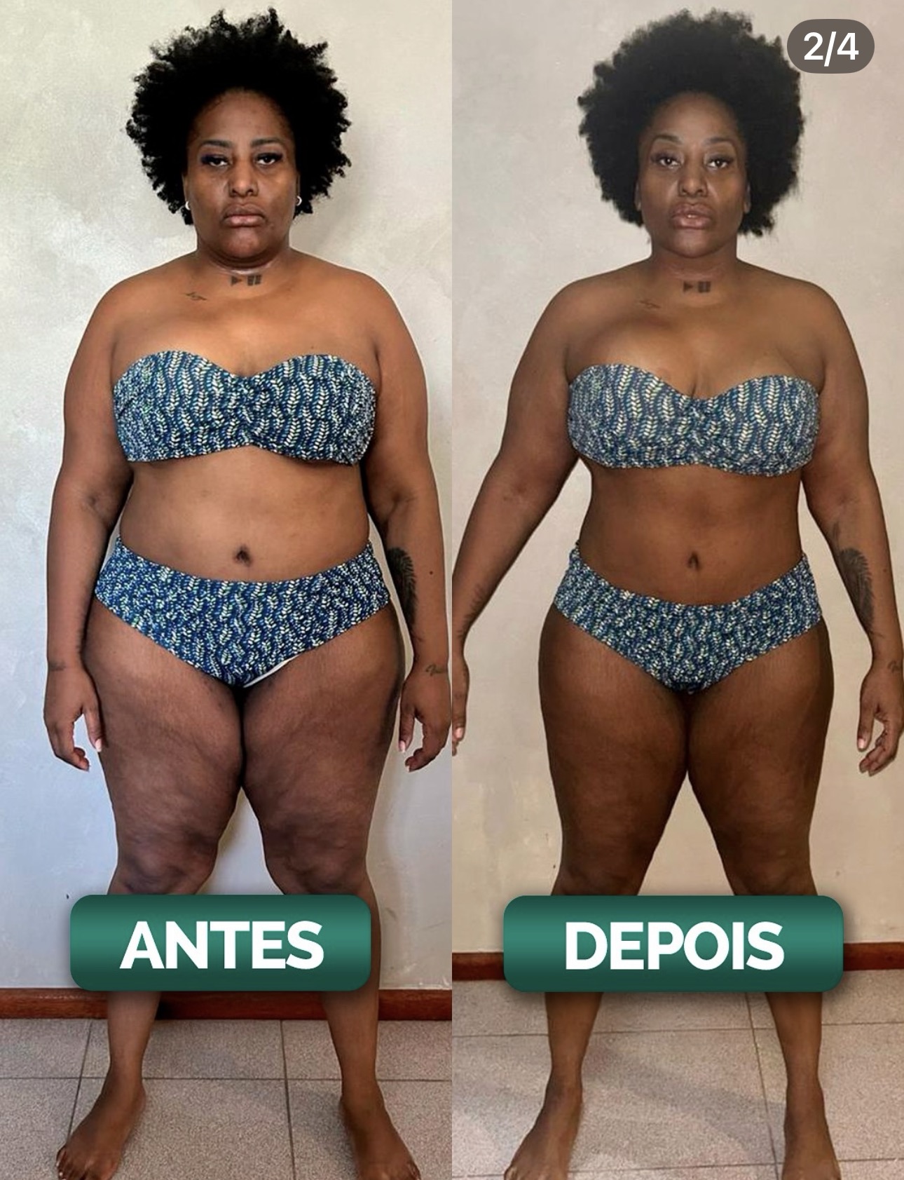 −26kg — frontal