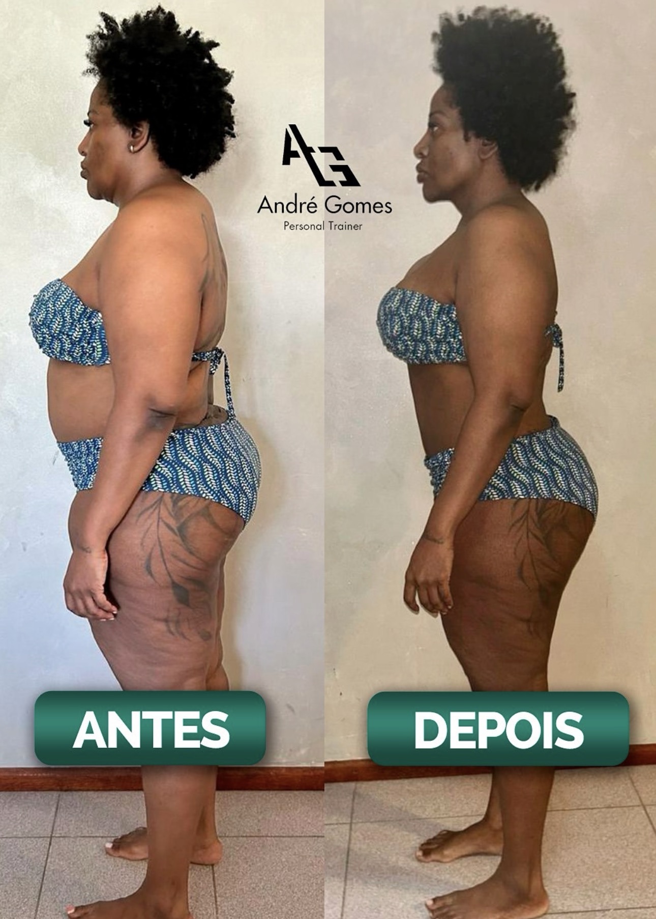 −26kg — lateral
