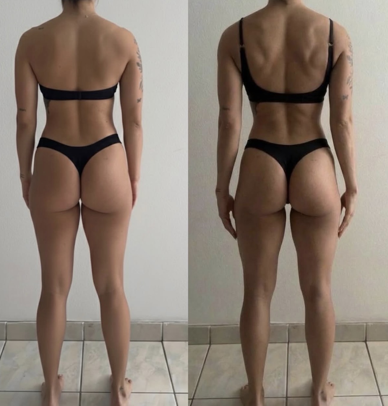 Posterior — antes & depois