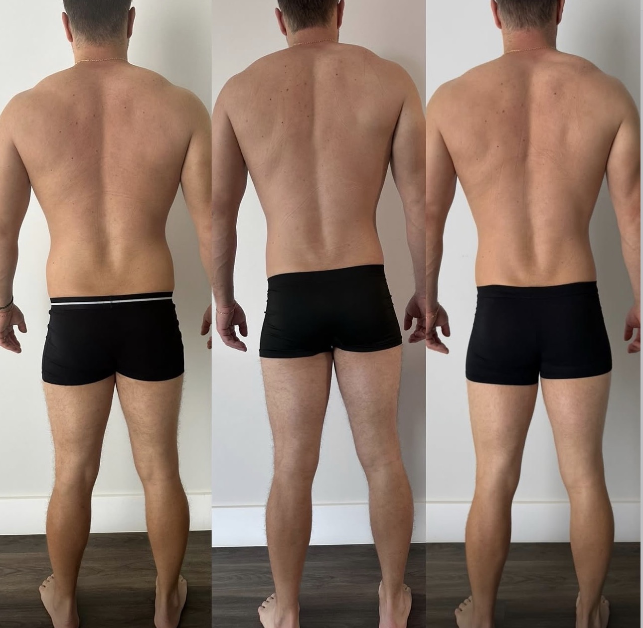 Evolução masculina — posterior